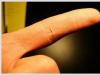 Несколько эффективных способов вытащить занозу из пальца Как вытащить занозу из пальца если она